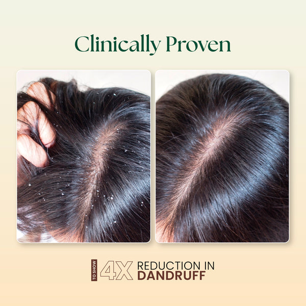 moha: 5 in 1 Hair Oil