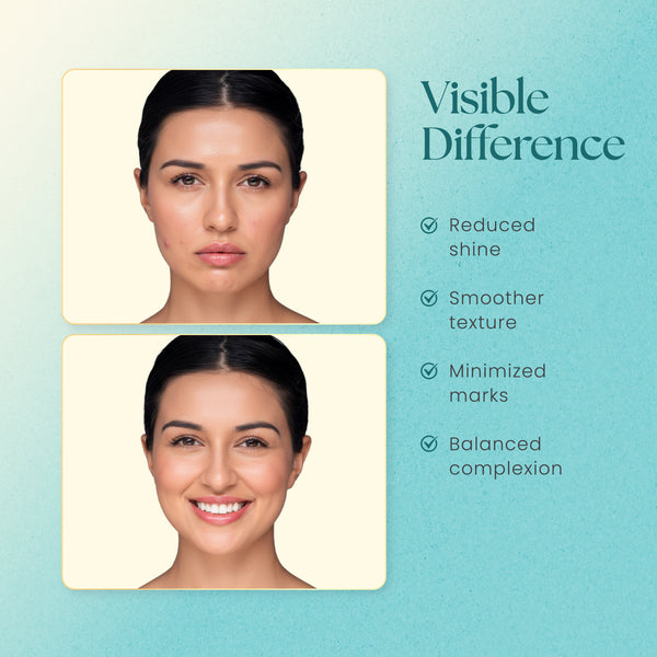 moha: Face Moisturiser for Oily Skin