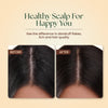 Dandruff Defense Trio: Restore Your Hair's Health