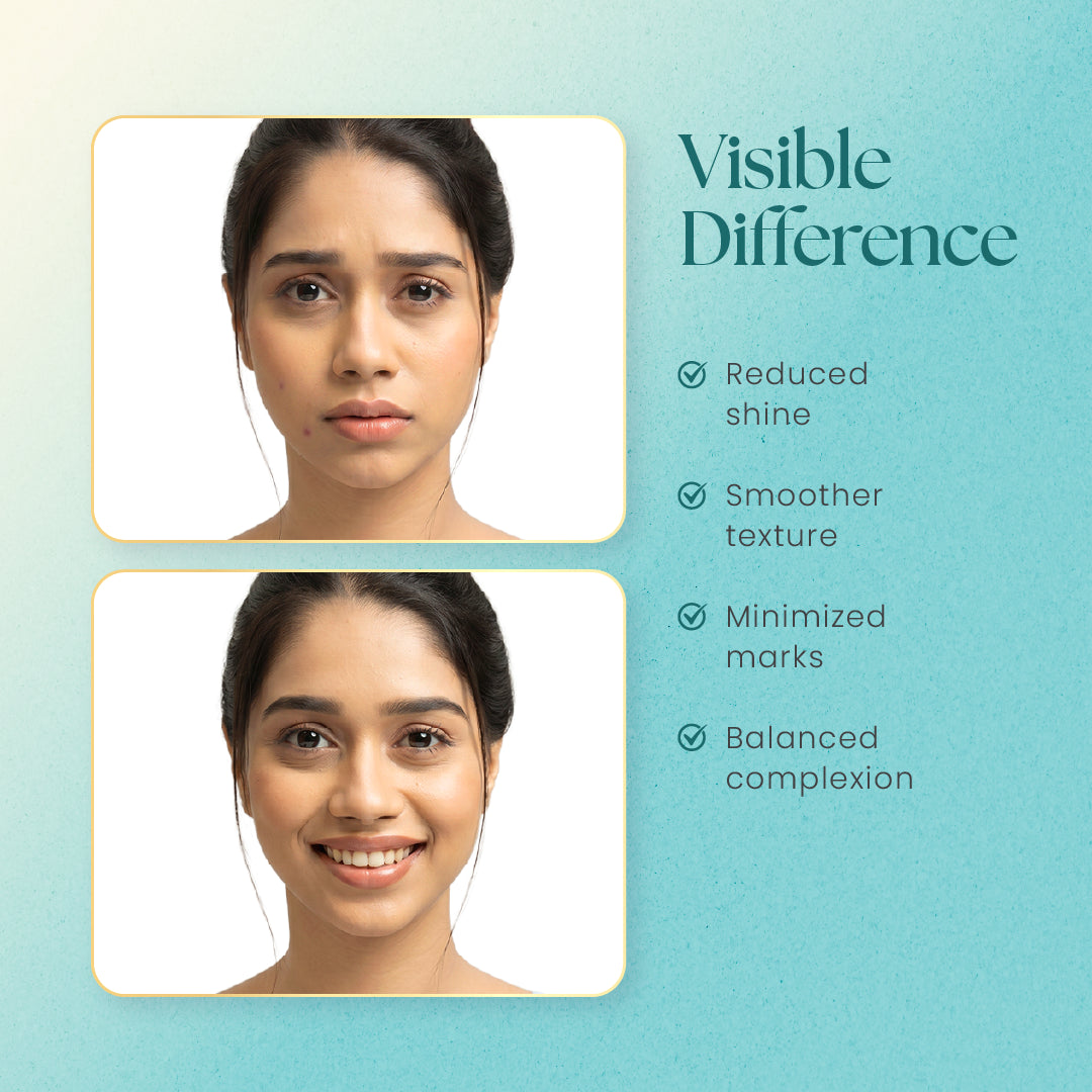 Face Moisturizer for Oily Skin