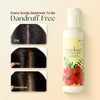 Anti Dandruff Scalp Care