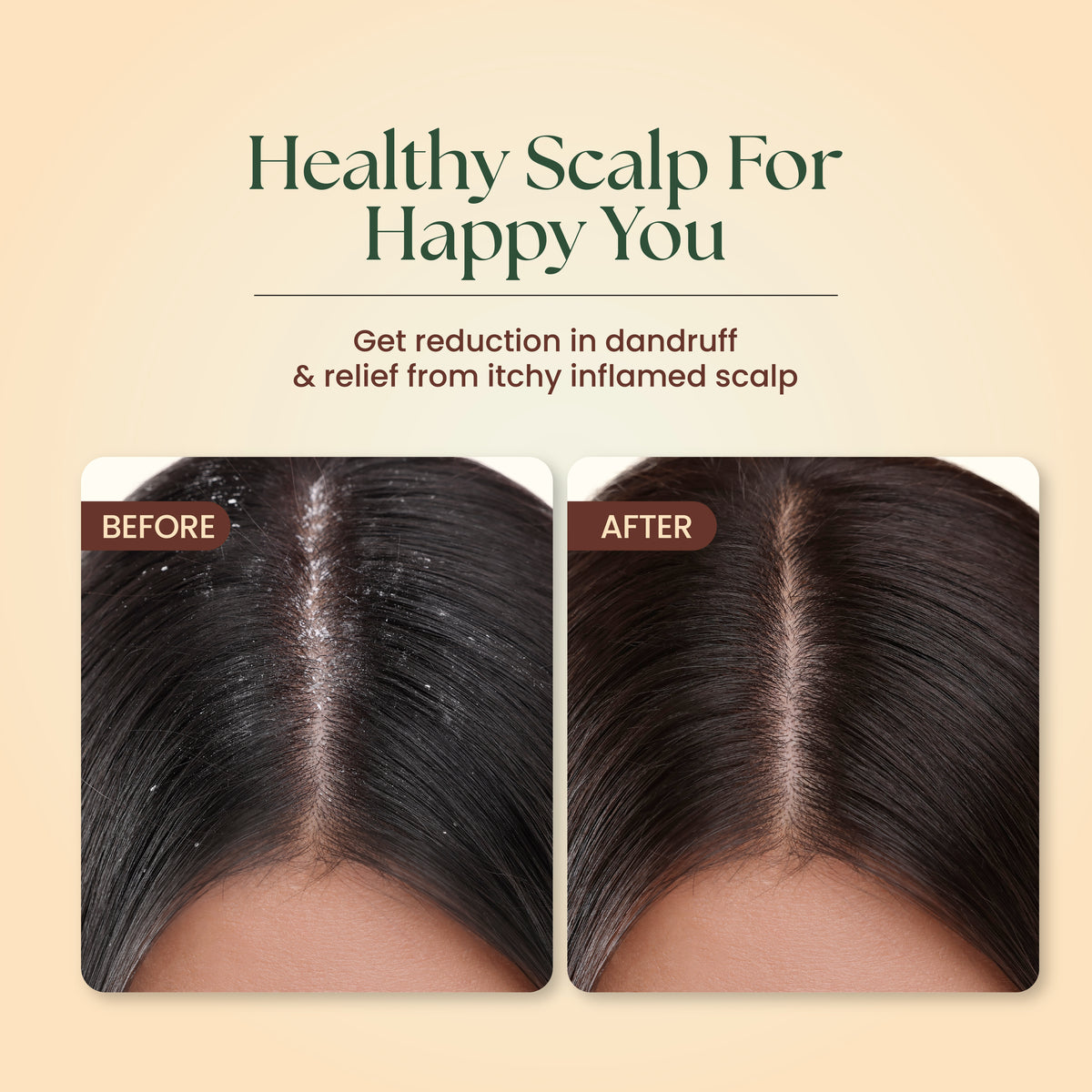 Anti Dandruff Neem & Hibiscus Shampoo with Tea Tree