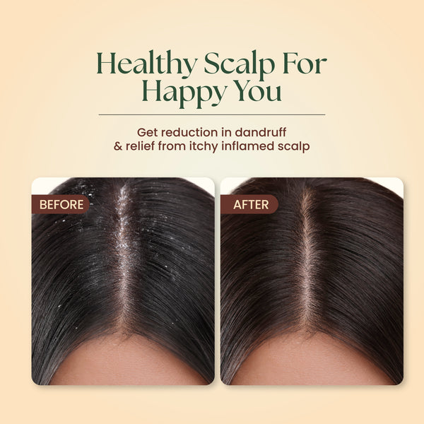 Neem & Hibiscus Shampoo