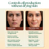 Oil Control Lepa — Ayurvedic Oil Control face mask for Oily & Acne-Prone Skin