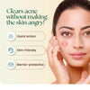 Acne Cleanse & Treat Ritual