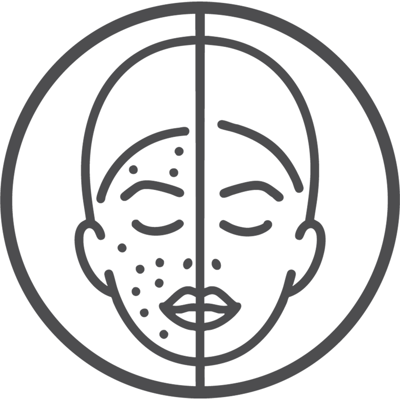 Reduces Tan  83% customers observed reduction in tan*