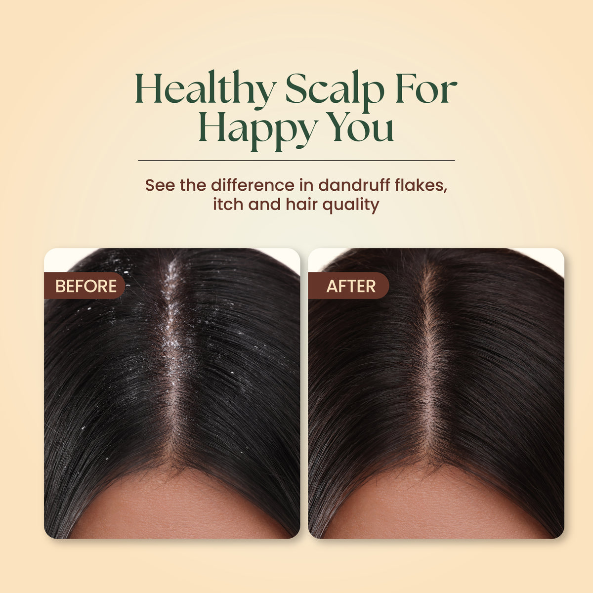 Dandruff Defense Trio: Restore Your Hair's Health