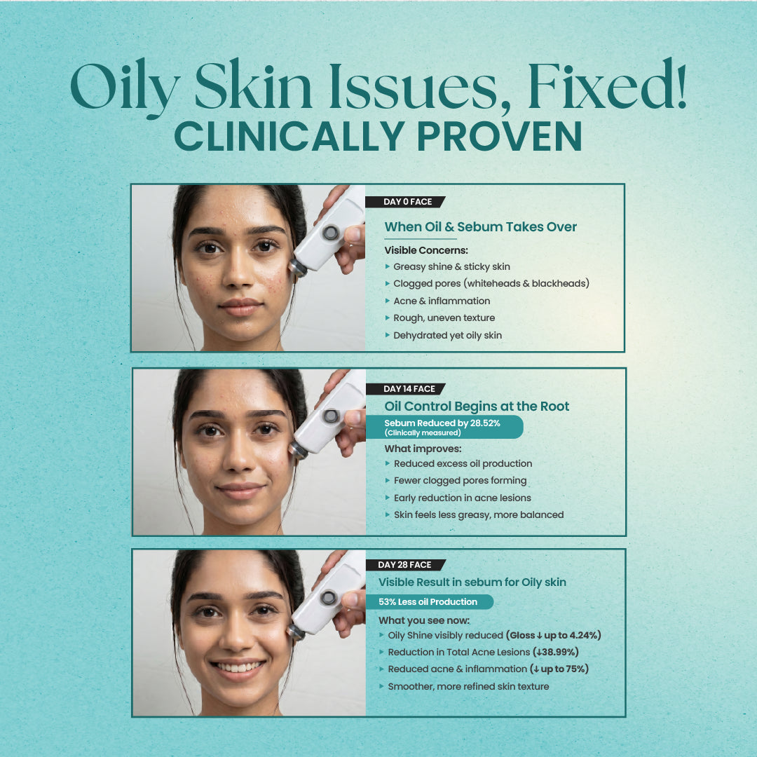 Face Moisturizer for Oily Skin