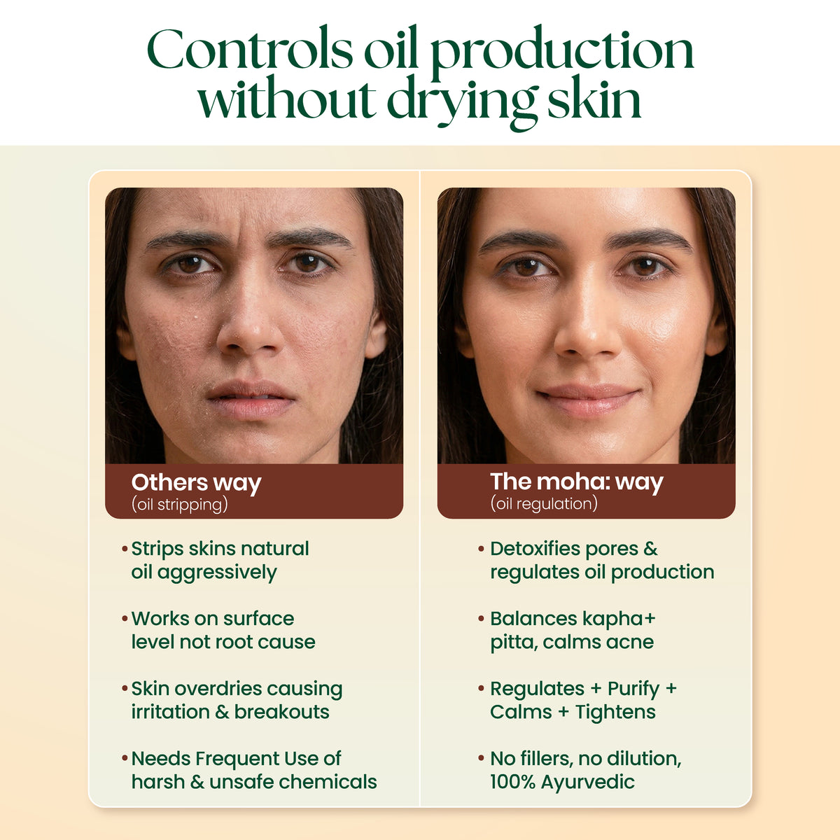 Oil Control Lepa — Ayurvedic Oil Control face mask for Oily & Acne-Prone Skin