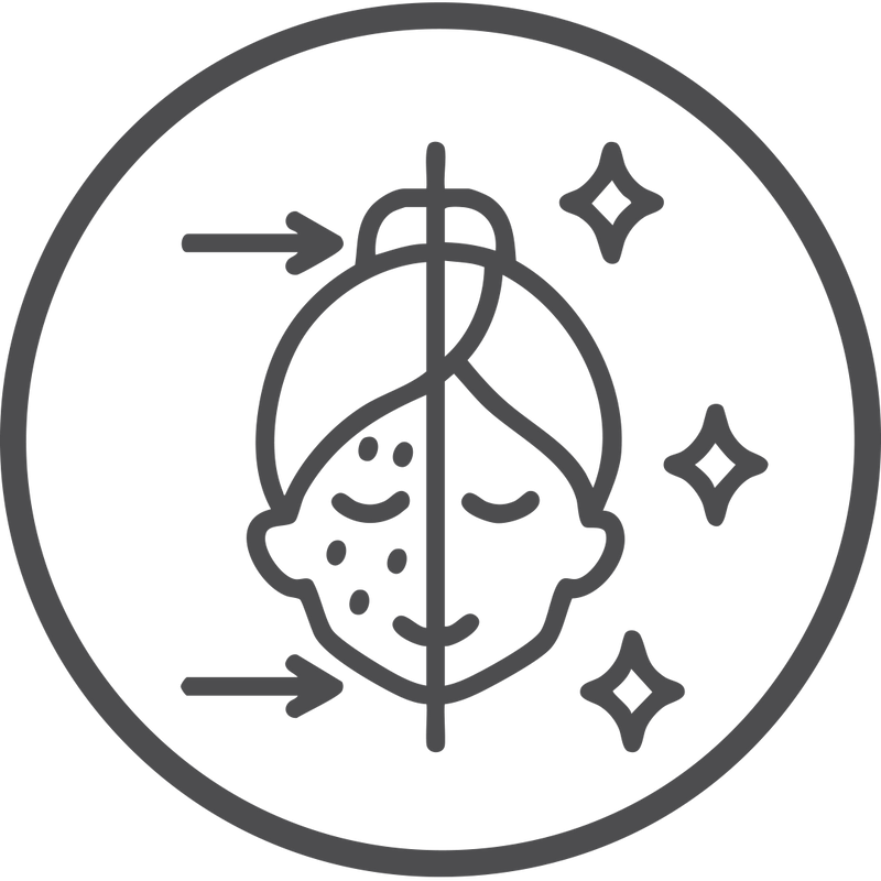  Prevents acne caused by hydration imbalance