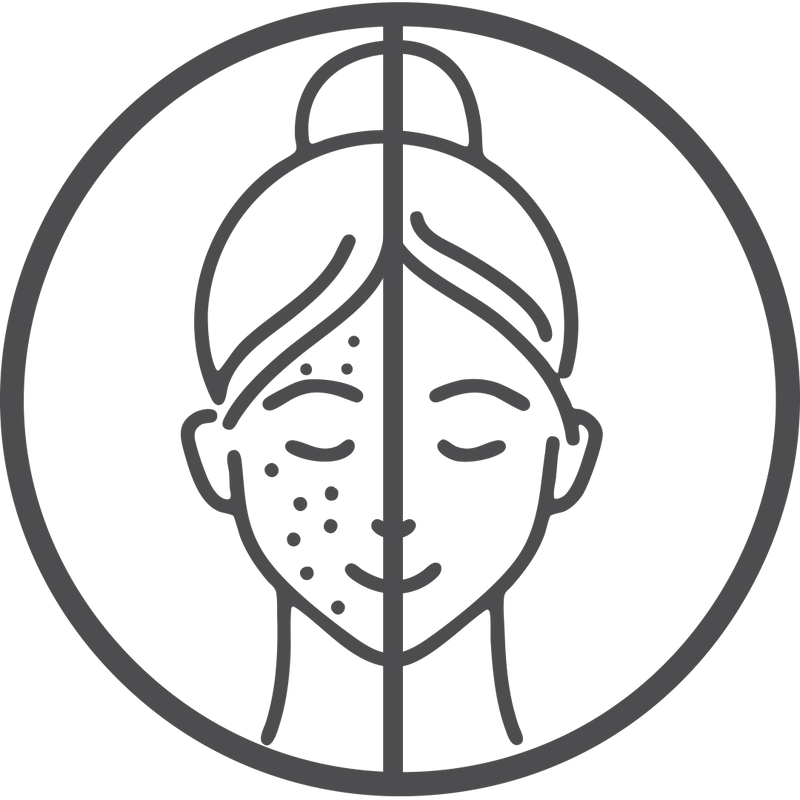 Reduces Dark Spots & Blemishes – Promotes clearer, even-toned skin